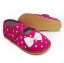 Anatomic barefoot Raspberry A